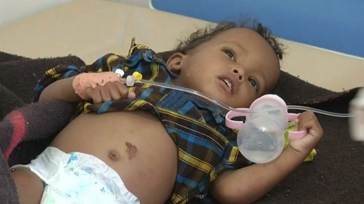 Yemen cholera epidemic spreads with nearly 250,000 infected