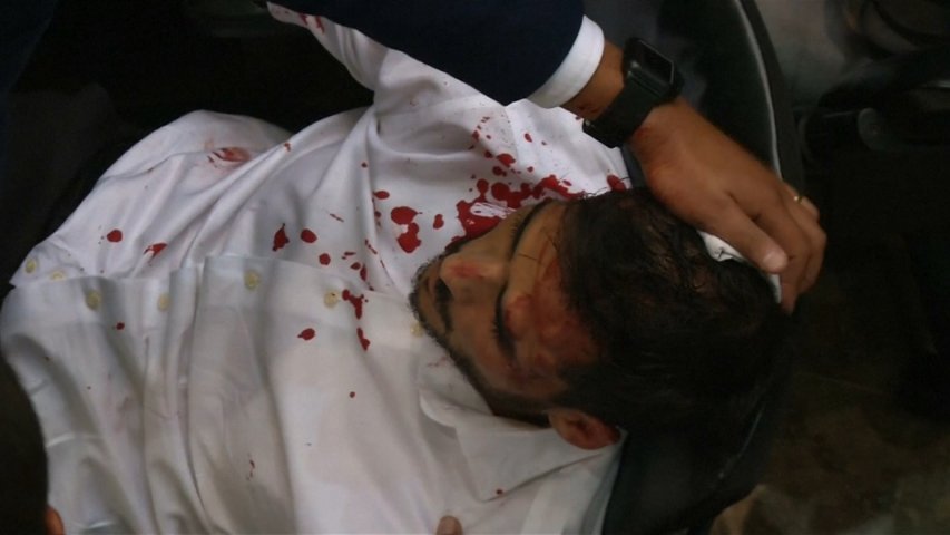 Lawmakers bloodied after pipe-wielding protesters storm Venezuelas National Assembly