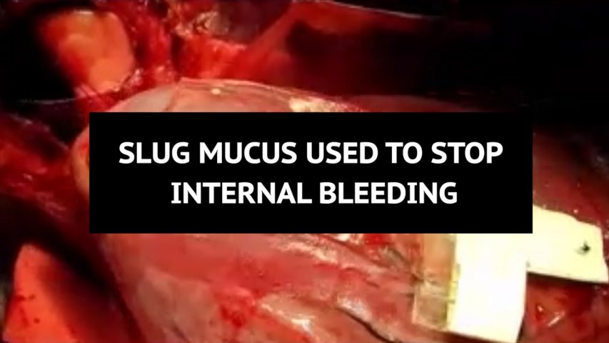 Slug mucus used to create super-strong glue that stops internal bleeding