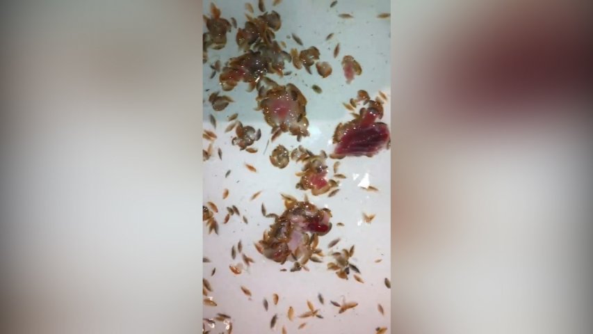 Brighton Beach critters swarm for meat after feasting on teens leg