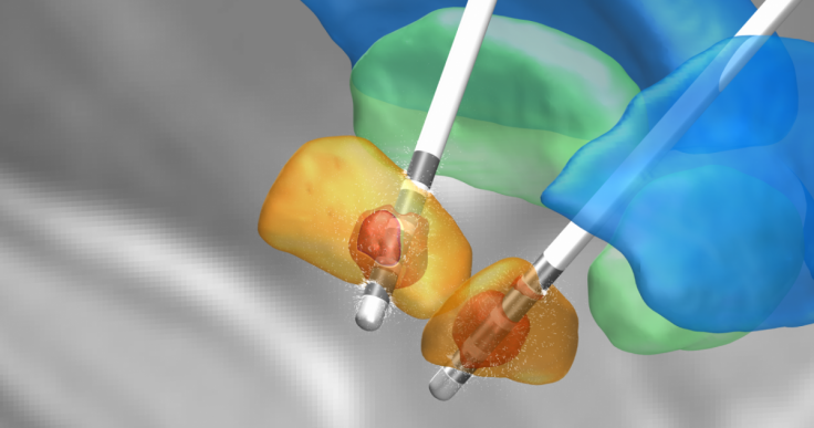 Brain simulation in Parkinson's disease