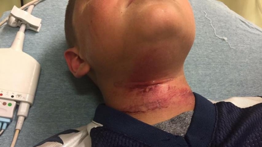 New Hampshire investigating alleged hanging of biracial boy