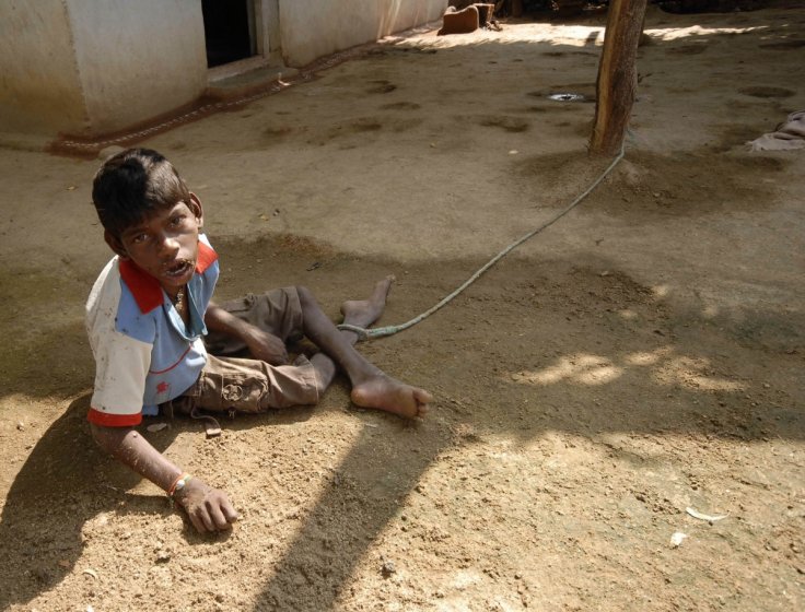 Fluoride affect child's intelligent Fluoride affect child's intelligent