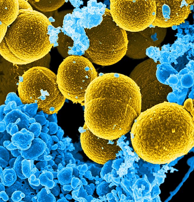 DATE IMPORTED:07 September, 2016A digitally-colorized scanning electron micrograph depicts a number of mustard-colored, spheroid-shaped Staphylococcus aureus bacteria in the process of escaping their destruction by blue-colored human white blood cells in 
