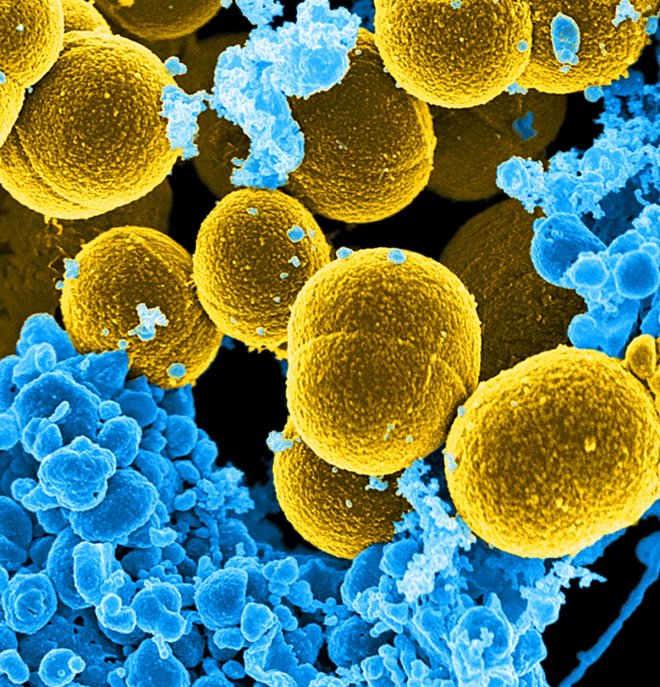 DATE IMPORTED:07 September, 2016A digitally-colorized scanning electron micrograph depicts a number of mustard-colored, spheroid-shaped Staphylococcus aureus bacteria in the process of escaping their destruction by blue-colored human white blood cells in DATE IMPORTED:07 September, 2016A digitally-colorized scanning electron micrograph depicts a number of mustard-colored, spheroid-shaped Staphylococcus aureus bacteria in the process of escaping their destruction by blue-colored human white blood cells in