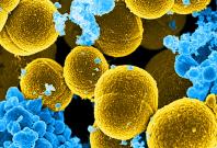 DATE IMPORTED:07 September, 2016A digitally-colorized scanning electron micrograph depicts a number of mustard-colored, spheroid-shaped Staphylococcus aureus bacteria in the process of escaping their destruction by blue-colored human white blood cells in 