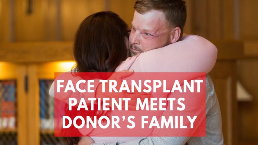 Heartwarming moment face transplant patient meets donors family