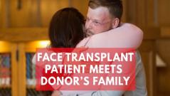 Heartwarming moment face transplant patient meets donors family