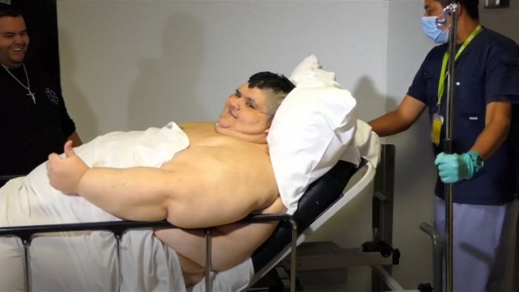 Worlds fattest man has surgery to halve his weight