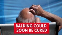New hair loss treatment could cure balding