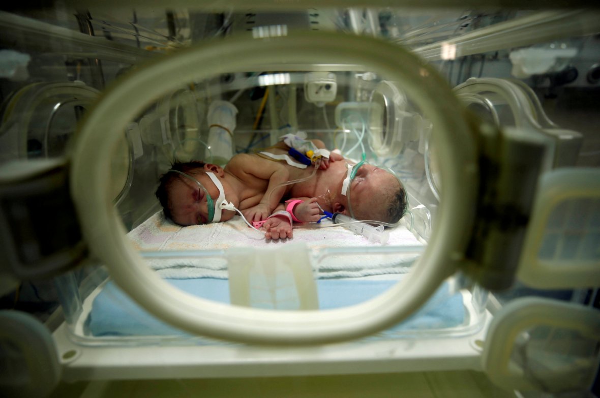 Conjoined twins Haneen and Farah are seen in an incubator at a hospital in Gaza