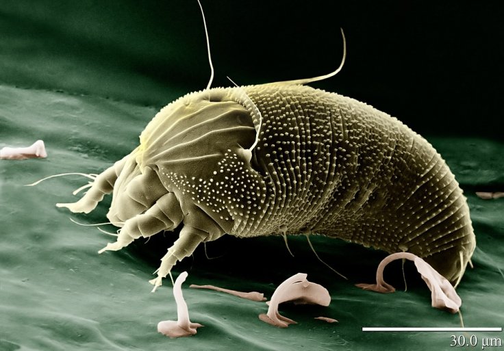 Dust mites