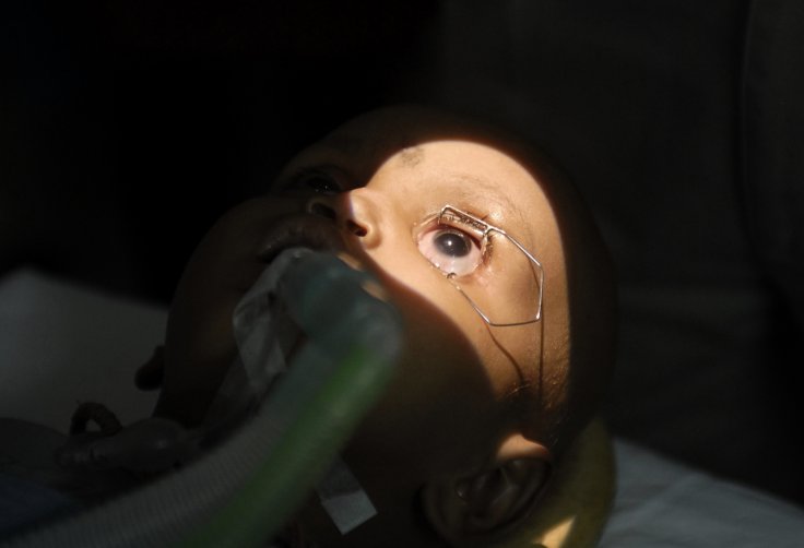 Eye cancer Eye cancer