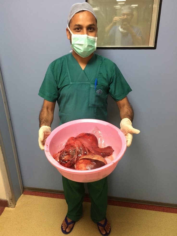 Two tumours removed from Tanzanin patient at Sir Ganga Ram Hospital Two tumours removed from Tanzanin patient at Sir Ganga Ram Hospital