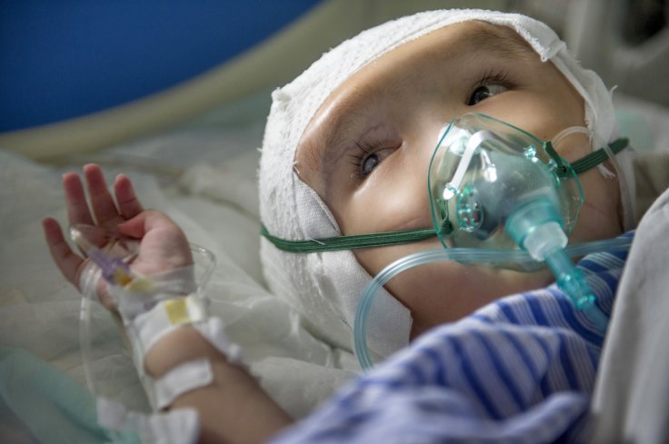 heart surgery in infant may cause deafness