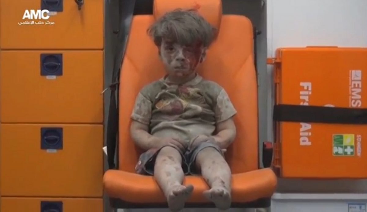 Syria: An injured boy is seen sitting in an ambulance after an airstrike