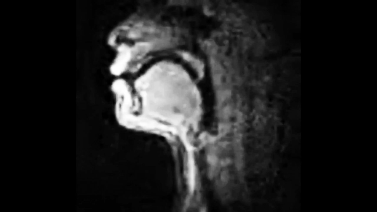 incredible-mri-scan-reveals-how-beatboxers-produce-sound