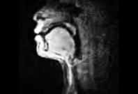 incredible-mri-scan-reveals-how-beatboxers-produce-sound