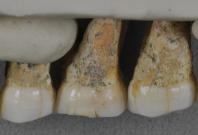 The teeth bones recovered from Callao Caves of the Philippines island of Luzon display characteristics of early humans as well as modern humans. From left: Two premolars and three molars.Courtesy: Callao Cave Archaeology Project