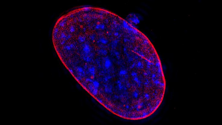 Researchers have found that higher levels of aneuploidy lead to much greater lethality among prostate cancer patients. This suggest a mechanism for how some prostate cancers become lethal, and could be used to alert doctors which patients might need to be Researchers have found that higher levels of aneuploidy lead to much greater lethality among prostate cancer patients. This suggest a mechanism for how some prostate cancers become lethal, and could be used to alert doctors which patients might need to be