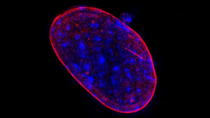 Researchers have found that higher levels of aneuploidy lead to much greater lethality among prostate cancer patients. This suggest a mechanism for how some prostate cancers become lethal, and could be used to alert doctors which patients might need to be