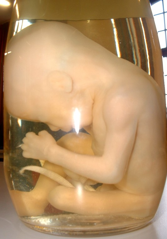 fetus fetus