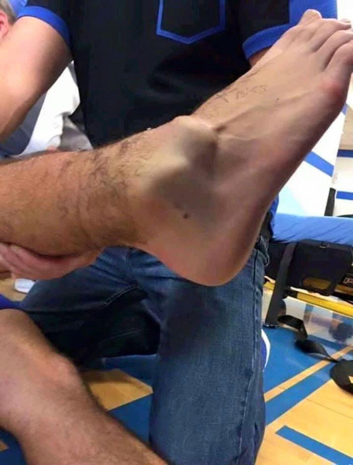 Andre Gomes injury Andre Gomes injury