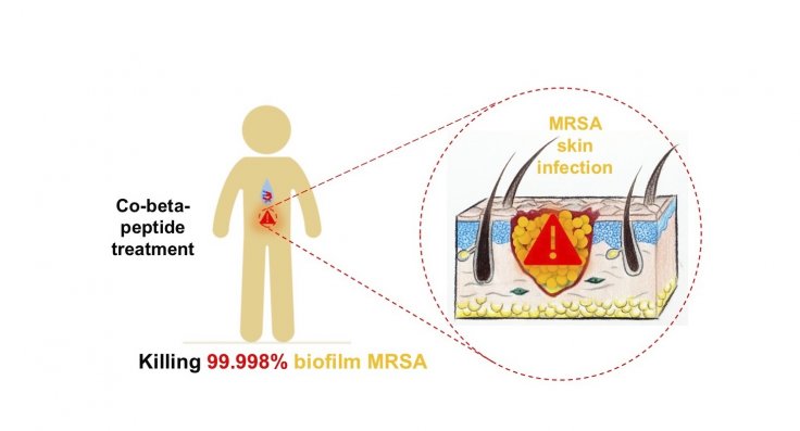 The co-beta peptide treatment is shown to eradicate biofilm bacteria such as MRSA, a particularly difficult form of bacteria to treat