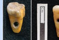 The two drilled 8,500-year-old human teeth found at Çatalhöyük in Turkey.