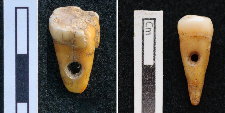 The two drilled 8,500-year-old human teeth found at Çatalhöyük in Turkey. The two drilled 8,500-year-old human teeth found at Çatalhöyük in Turkey.
