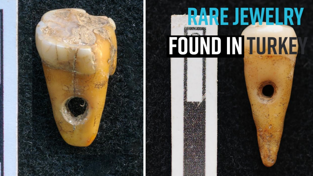 rare-8500-year-old-human-teeth-used-as-jewelry-discovered-in-turkey