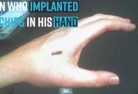 man-who-implanted-chips-in-his-hand