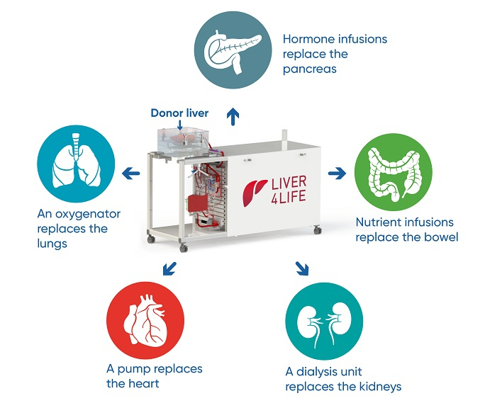 perfusion machine