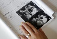 Japans population shrinks by one million; first drop in almost 100 years Japans population shrinks by one million; first drop in almost 100 years