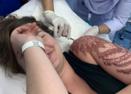 Tourist suffers chemical burn from black henna
