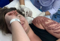 Tourist suffers chemical burn from black henna Tourist suffers chemical burn from black henna