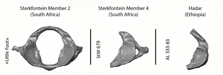 Cervical vertebra