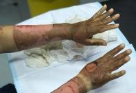 This photo is being shared with the fake message: "Please do not go near stove/fire after applying alcohol-based hand sanitizers" This photo is being shared with the fake message: "Please do not go near stove/fire after applying alcohol-based hand sanitizers"