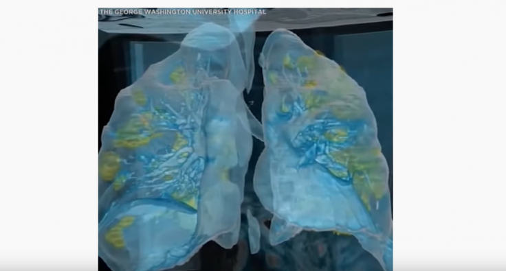 Coronavirus lungs 3D graphics by GW University