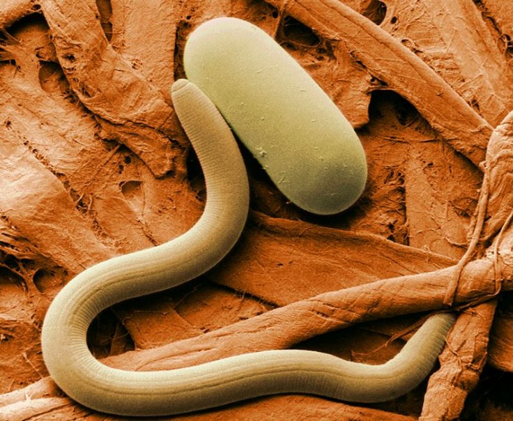 Roundworm