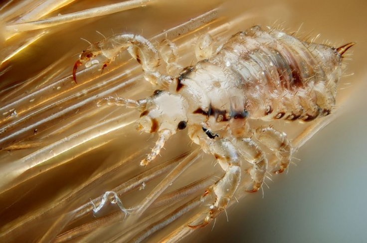 Human Lice