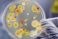 coronavirus farts in petri dish