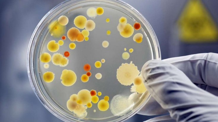 coronavirus farts in petri dish coronavirus farts in petri dish