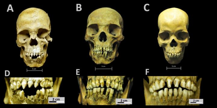 Skulls discoverd in Mexico