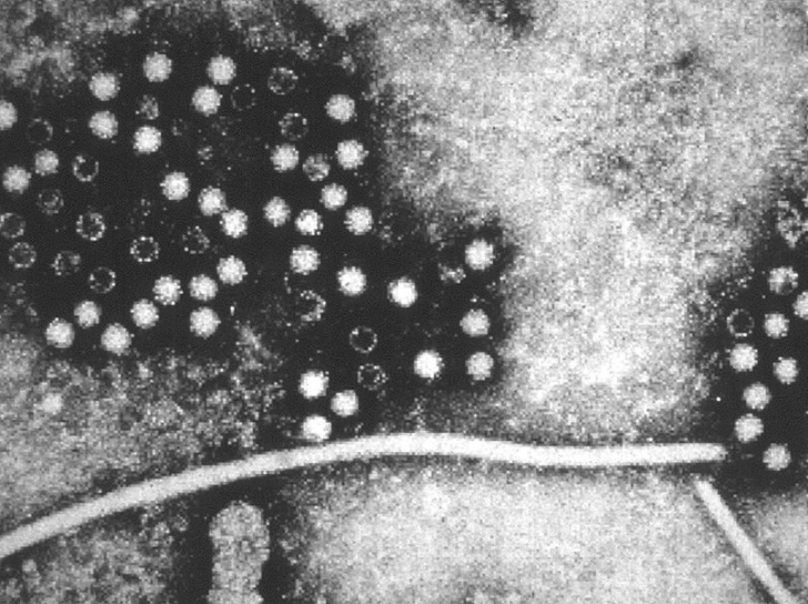 Hepatitis E virus