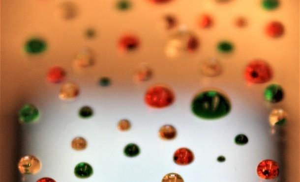 Kidney stone issues Kidney stone issues