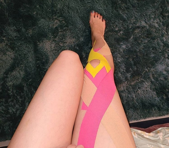 Sunmi leg injury