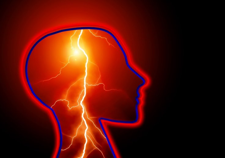 Epilepsy Epilepsy