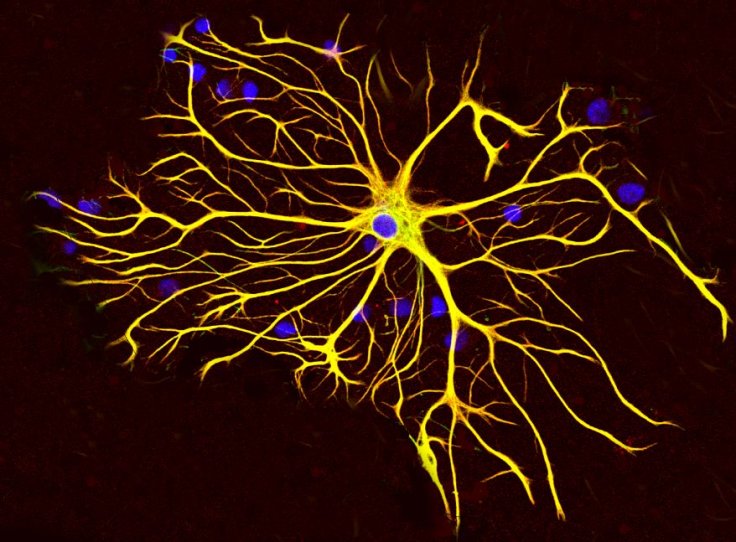 Astrocyte