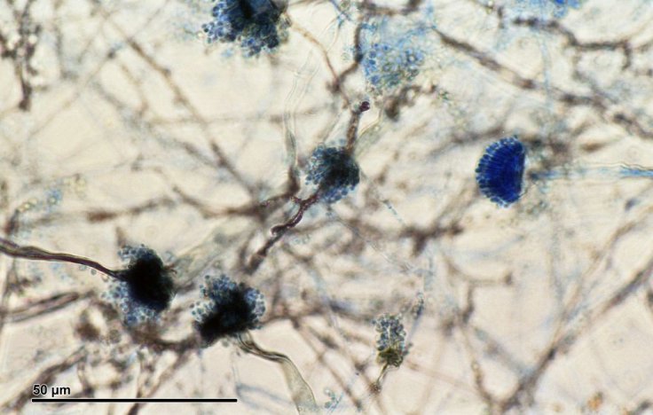 Aspergillus fumigatus